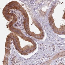 FAM21A Antibody, Novus Biologicals 100uL; Unlabeled:Antibodies, Polyclonal